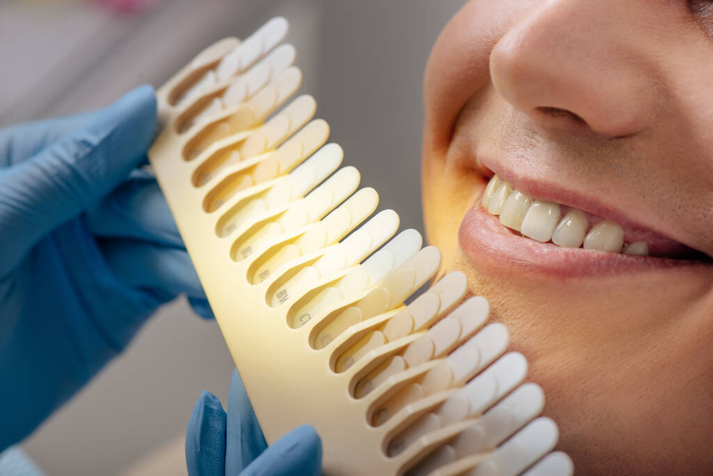 teeth whitening